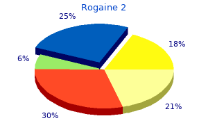 buy generic rogaine 2 60 ml on line