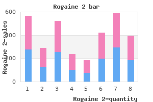 cheap generic rogaine 2 canada